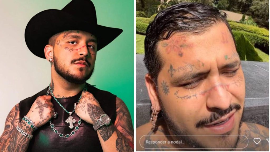 Christian Nodal Así va el tratamiento para borrar los tatuajes de su