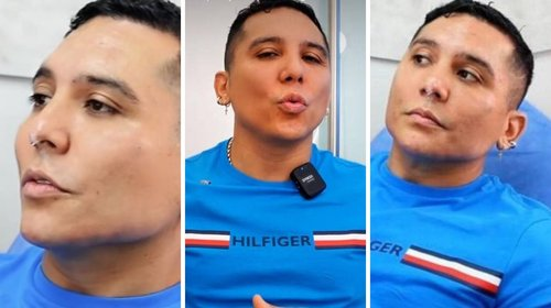 Edwin Luna es criticado por su nuevo aspecto