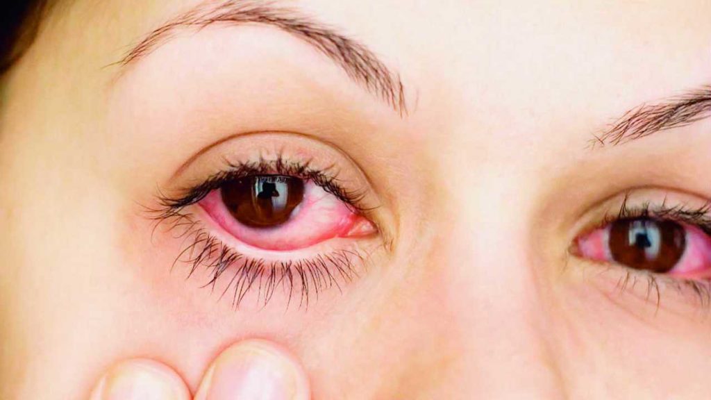 ¡Mujer asegura curar enfermedades de la vista lamiendo los ojos!