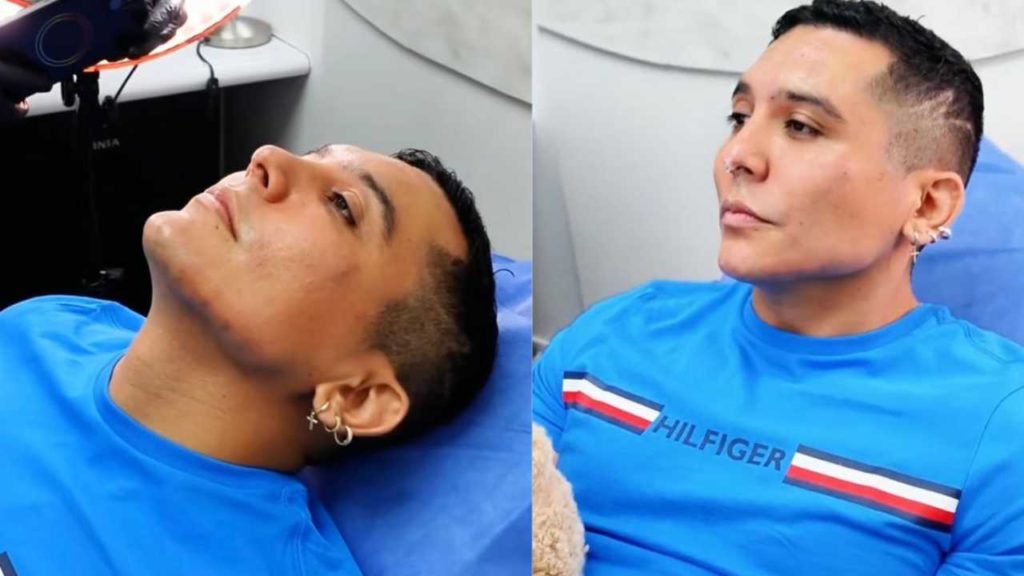 Edwin Luna responde a críticas por sus arreglos estéticos