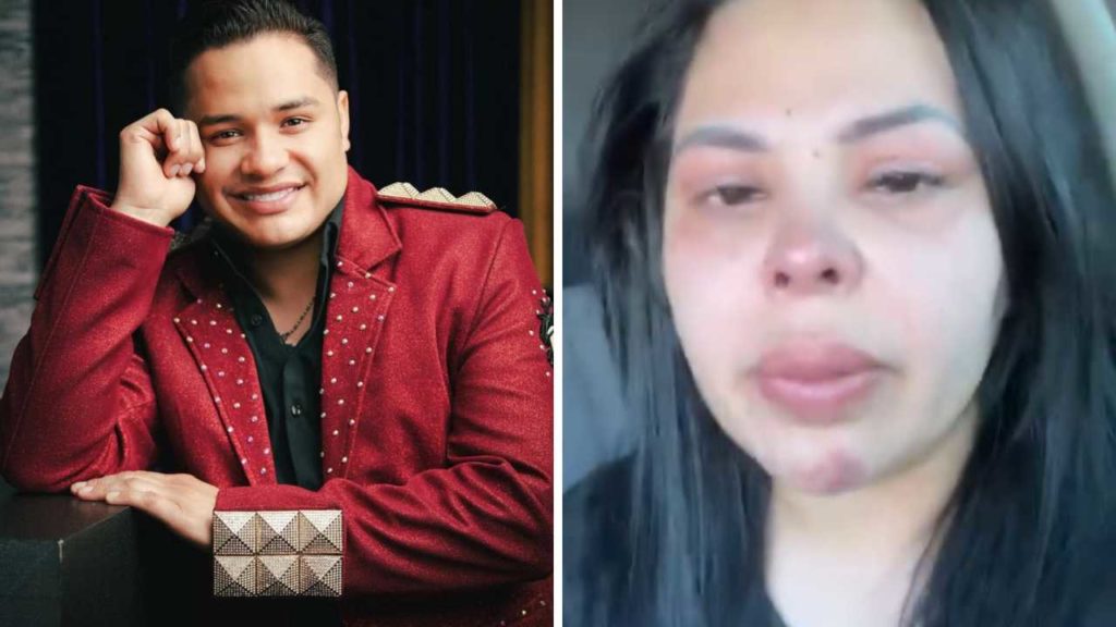 Rafa González rompe el silencio: "Me están difamando", dice el vocalista de Los Recoditos tras acusaciones de violencia